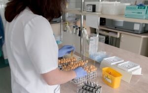 Новини Києва - Спалах гепатиту А в Києві пішов на спад