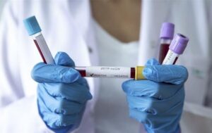 В Україні зафіксували понад 3,5 тис. випадків COVID за тиждень