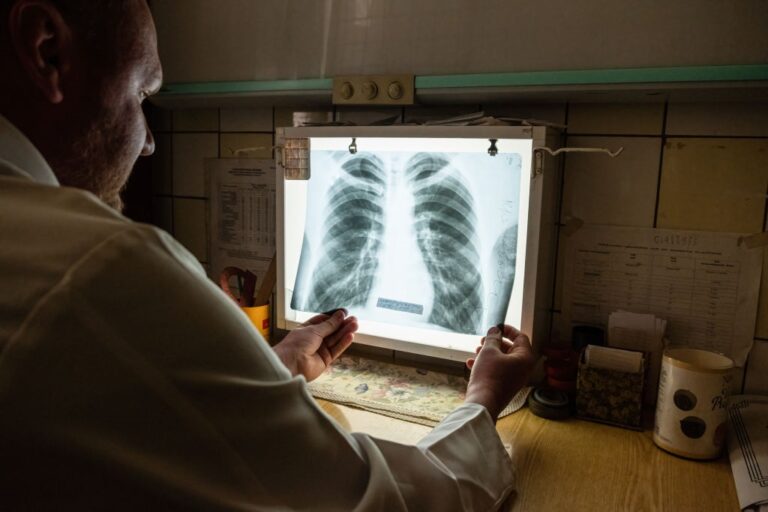 В Україні з’являються випадки позалегеневого туберкульозу – ЦГЗ